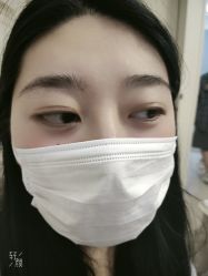 体验后-紫洁俪方（北京）医疗美容