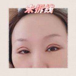 -素美医疗美容·西南眼鼻整形·修复基地