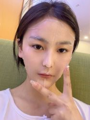 -正璞医疗美容·皮肤修复·微整注射