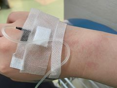 -无锡市第二人民医院(南院)