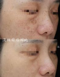 -半岛故事·法儿曼抗衰·indiba中心