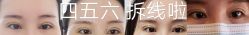-八大处整形