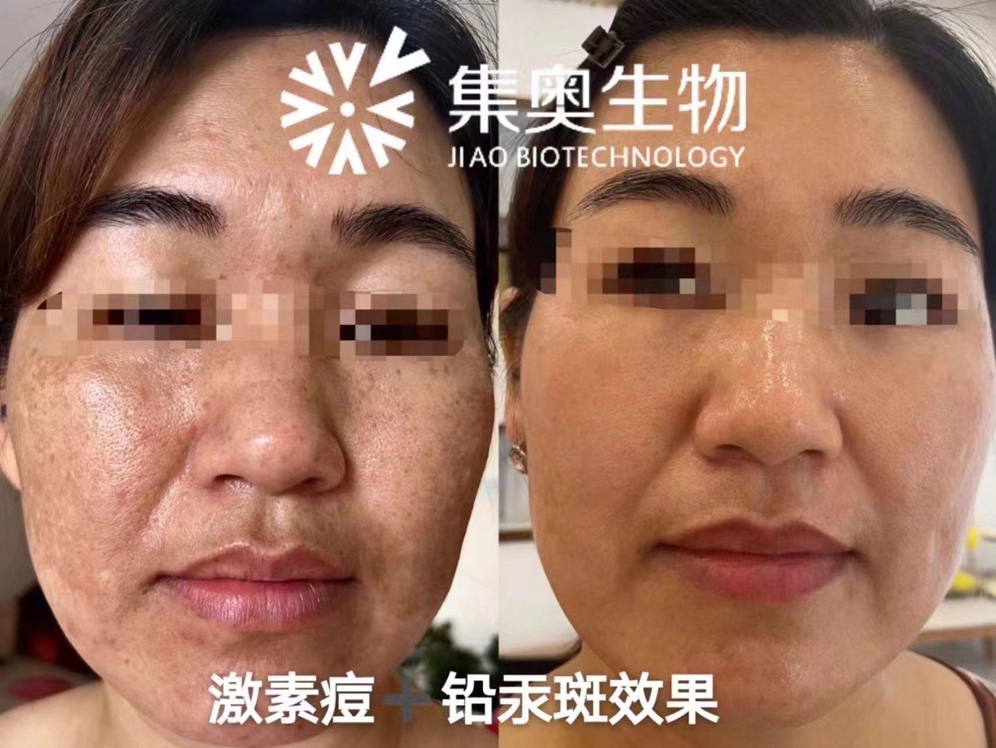 敏兮#肤卉产品技术效果
73 精研问