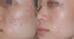 -SKINIST丽铂医疗美容