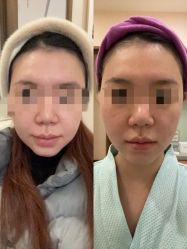 -北京米扬丽格医疗美容·联合丽格鼻整形中心