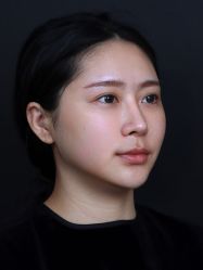 体验后-南宁华美医疗美容医院