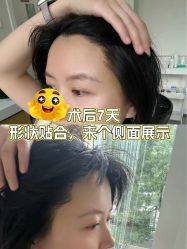 -雍禾植发全国连锁