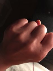 -晶奕空间专业脱毛连锁机构
