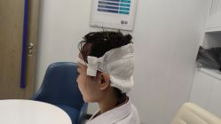 -大麦微针植发全国连锁