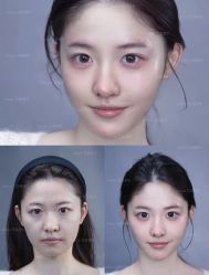 -Yestar艺星医疗美容医院