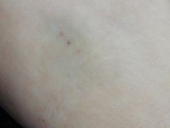 -浙江大学医学院附属第一医院(庆春院区)