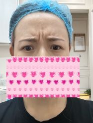 体验前-广州美莱医疗美容医院