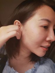 体验后-美莱医疗美容医院