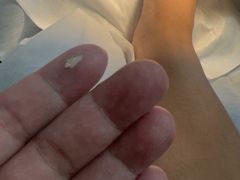 -世龙世家灰指甲鸡眼脚气甲沟炎跖疣护理(通州店)