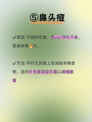 -克丽缇娜