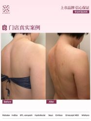 -Fundi张玉珊修身堂·indiba·BTL科技瘦身