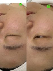 -凡碧诗毛孔清洁收细