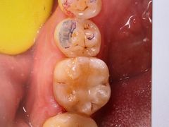 -方津口腔(旺墩路店)