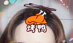 -大麦微针植发全国连锁