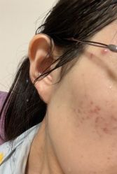 体验前-禾美嘉医疗美容