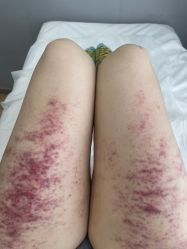 -简悦美塑·徒手点穴减肥