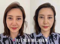 -LUNA皮相美·骨相美高级美感