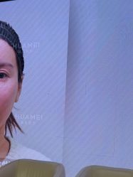 -北京画美医疗美容医院