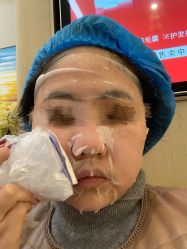 体验后-成都艾特他整形外科医院