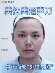 -Yestar重庆艺星医疗美容医院