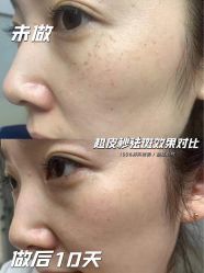 -LUNA皮相美·骨相美高级美感