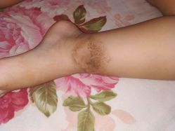 -丽美妍医疗美容·皮秒·立体分层抗衰