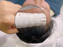 -美肤盾祛痘·问题肌头疗管理中心