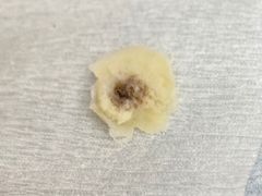 -世龙世家灰指甲·甲沟炎·跖疣护理·修脚(东江湾路店)