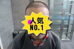 -大麦微针植发丨全国连锁