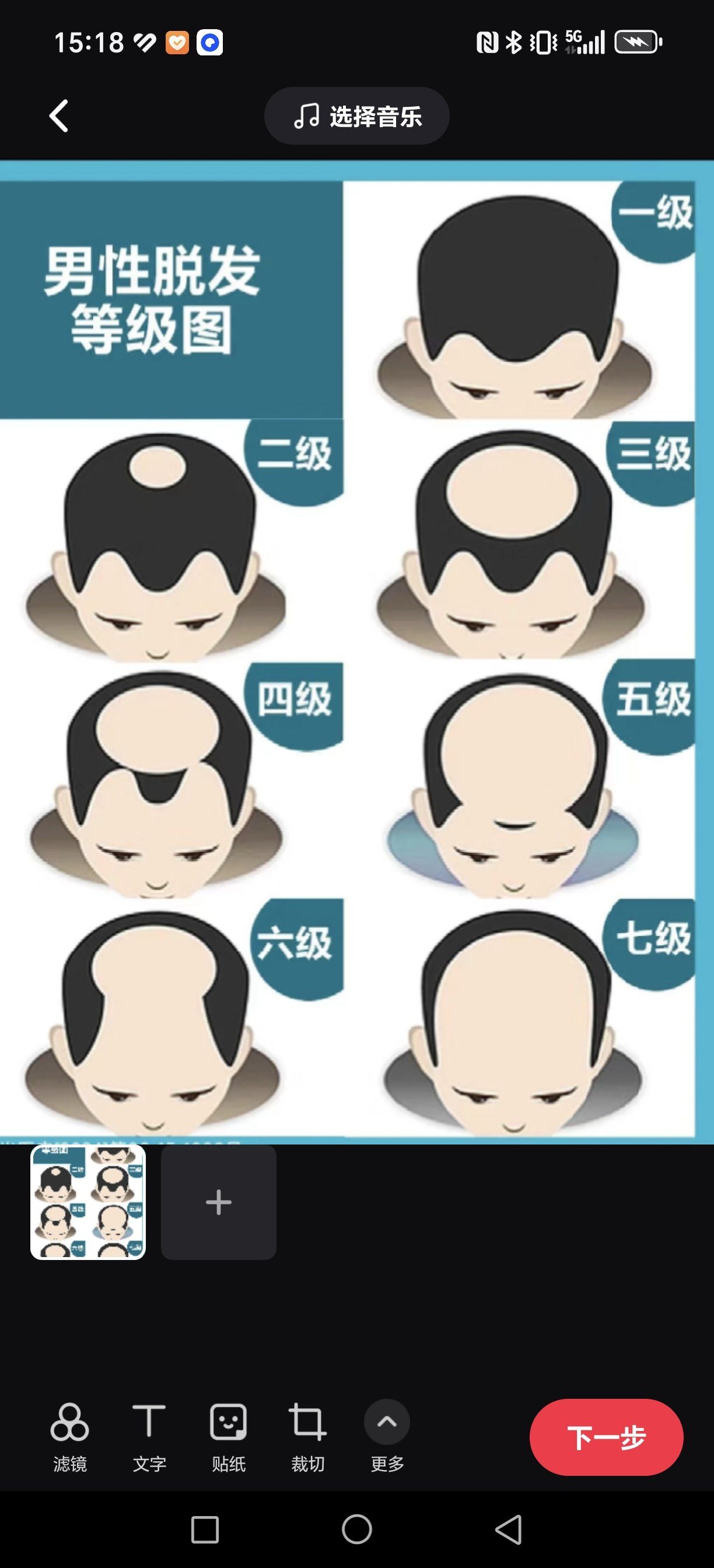 你是几级脱发?