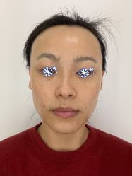 点击看大图 体验后-Dr.U博士医疗美容医院