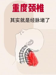 -克丽缇娜