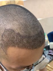 -熙朵美学植发·连锁品牌