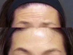 -深圳春天阳光医院·轮廓抗衰中心