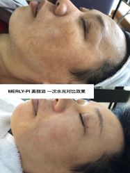-MLP美丽派·问题肌疗愈中心
