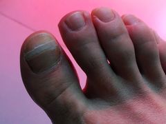 -新甲连锁灰指甲·甲沟炎·鸡眼(黑龙江路店)