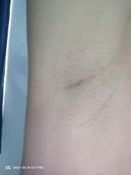 点击看大图 -薇兰专业脱毛连锁机构