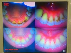 -土豆口腔(凤凰北总店)