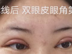 -苏州大学理想眼科医院