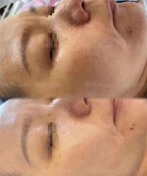 -LUNA皮相美·骨相美高级美感