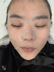体验后-北京楚诺医疗美容