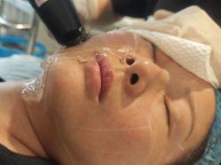 -安徽合肥韩美整形外科医院