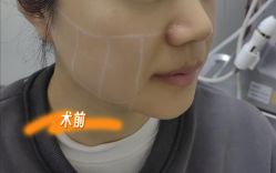 -长沙雅美医疗美容医院