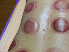 -沈师傅盲人按摩工作室(密三小区店)