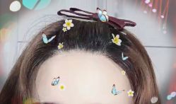 -大麦微针植发全国连锁